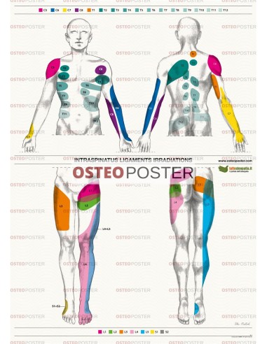Osteoposter - Irradiazione Legamenti Interspinosi Verticale