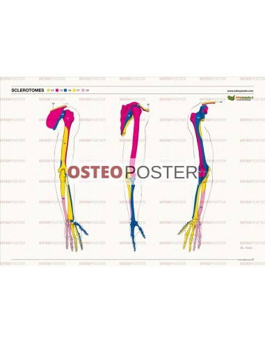 Osteoposter - Sclerotomi Braccia