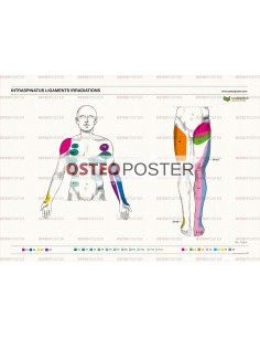 Osteoposter - Irradiazione Legamenti Interspinosi Frontale